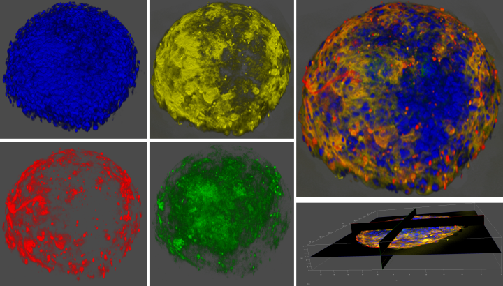 3D confocal microscopy images of human cardiac spheroid