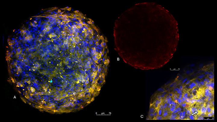 Fluorescent confocal microscopy images of human cardiac spheroids 